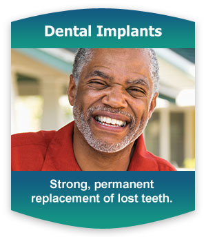 Dental Implants